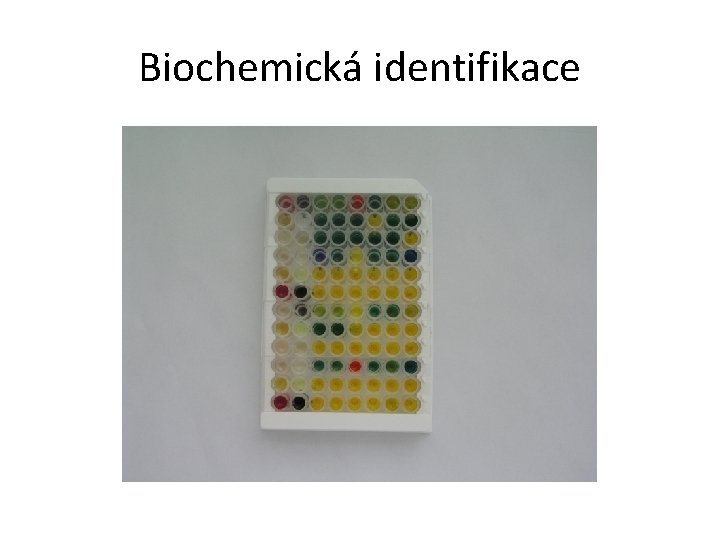 Biochemická identifikace 