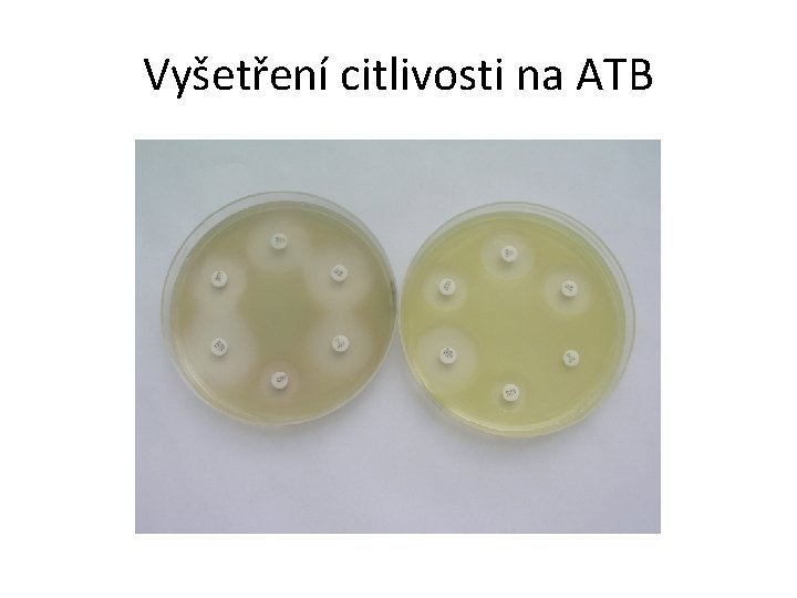 Vyšetření citlivosti na ATB 