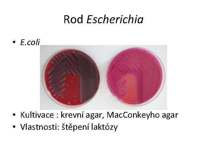 Rod Escherichia • E. coli • Kultivace : krevní agar, Mac. Conkeyho agar •