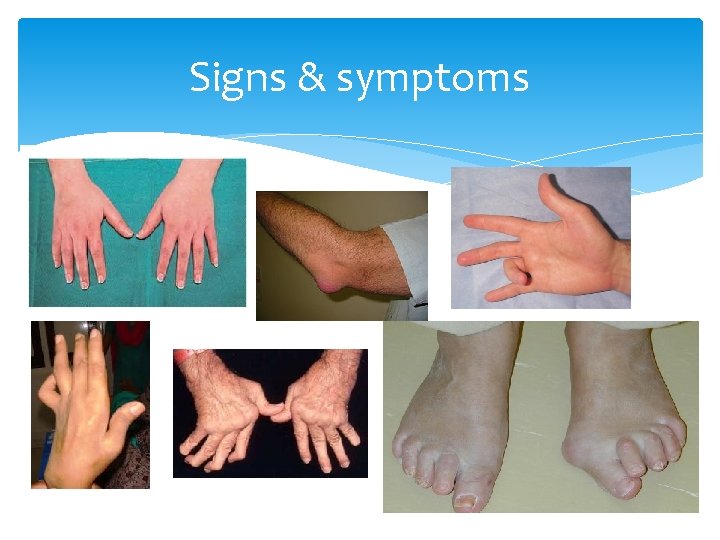 Signs & symptoms 