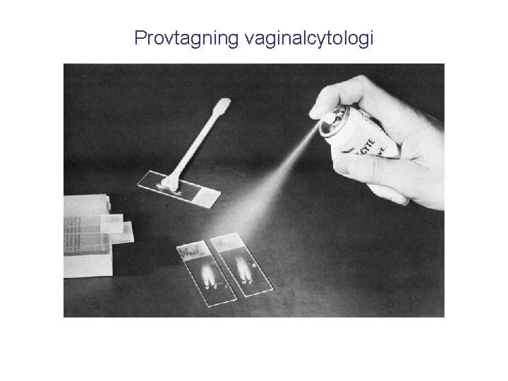 Provtagning vaginalcytologi 
