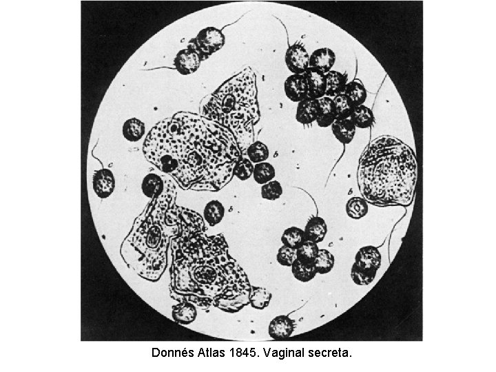 Donnés Atlas 1845. Vaginal secreta. 