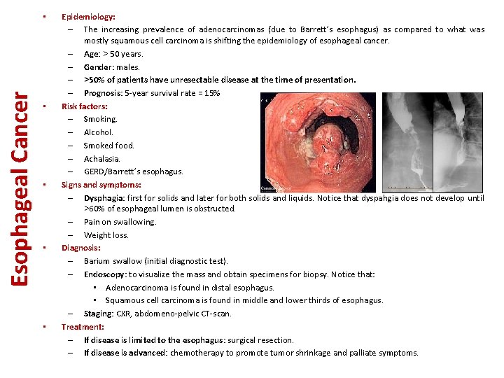 Esophageal Cancer • • • Epidemiology: – The increasing prevalence of adenocarcinomas (due to