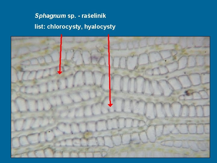 Sphagnum sp. - rašeliník list: chlorocysty, hyalocysty 