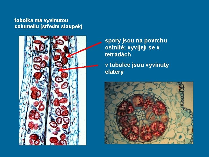 tobolka má vyvinutou columellu (střední sloupek) spory jsou na povrchu ostnité; vyvíjejí se v