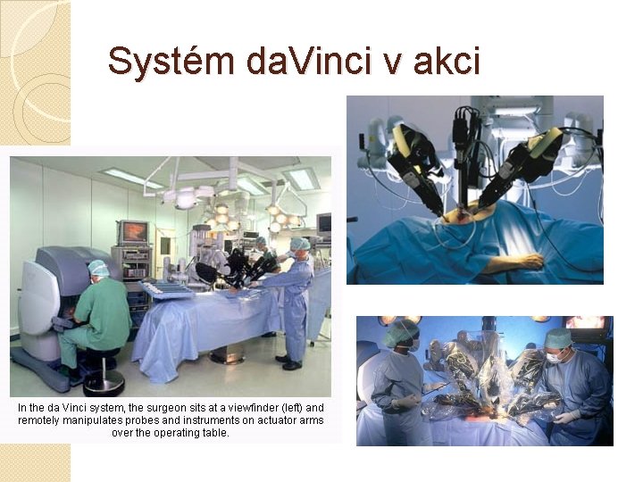 Systém da. Vinci v akci 