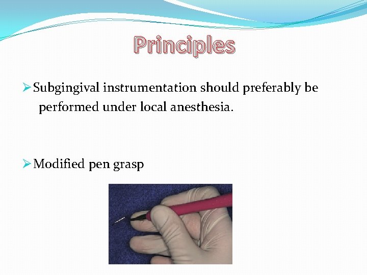Principles Ø Subgingival instrumentation should preferably be performed under local anesthesia. Ø Modified pen