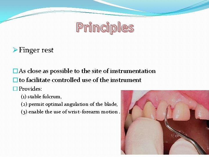 Principles Ø Finger rest �As close as possible to the site of instrumentation �to