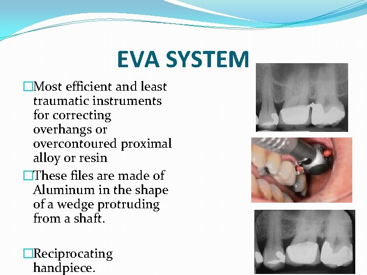 EVA SYSTEM �Most efficient and least traumatic instruments for correcting overhangs or overcontoured proximal