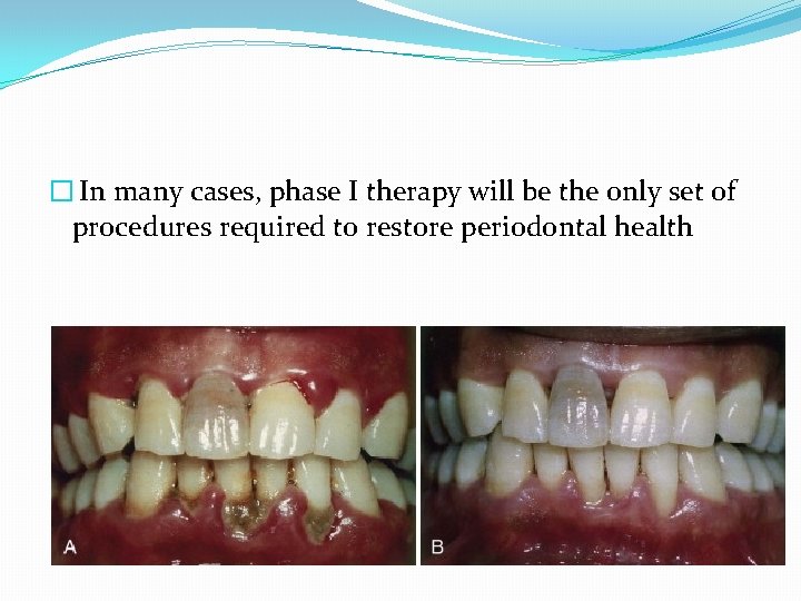 � In many cases, phase I therapy will be the only set of procedures