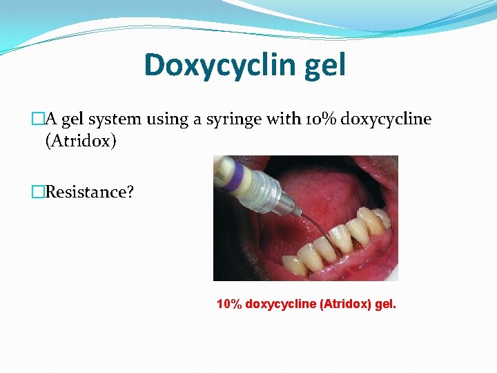 Doxycyclin gel �A gel system using a syringe with 10% doxycycline (Atridox) �Resistance? 10%