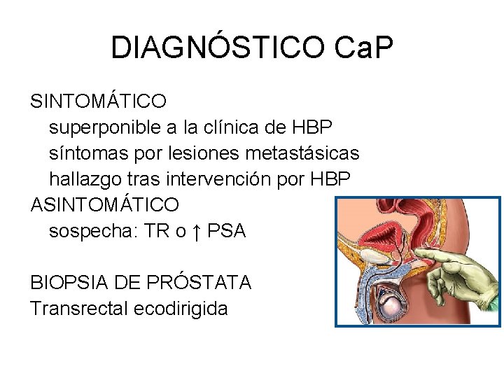 DIAGNÓSTICO Ca. P SINTOMÁTICO superponible a la clínica de HBP síntomas por lesiones metastásicas