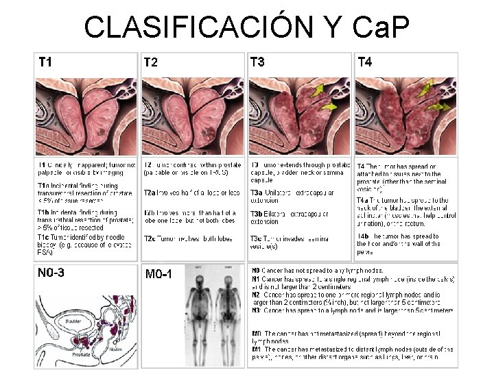 CLASIFICACIÓN Y Ca. P 