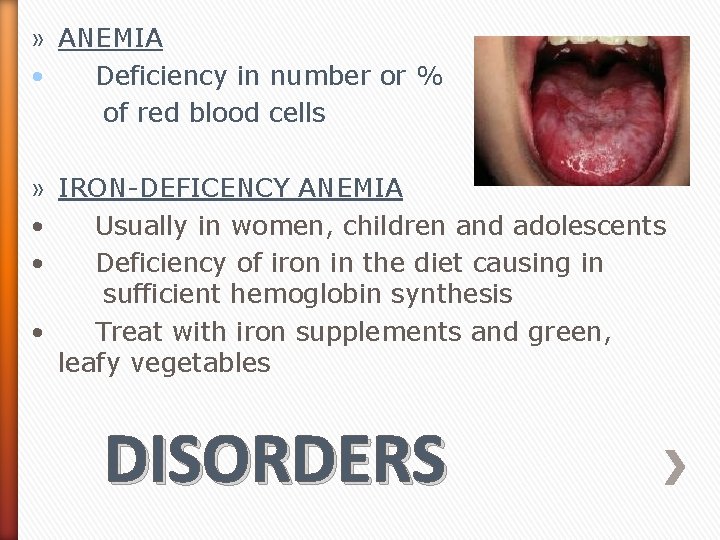 » ANEMIA • Deficiency in number or % of red blood cells » IRON-DEFICENCY