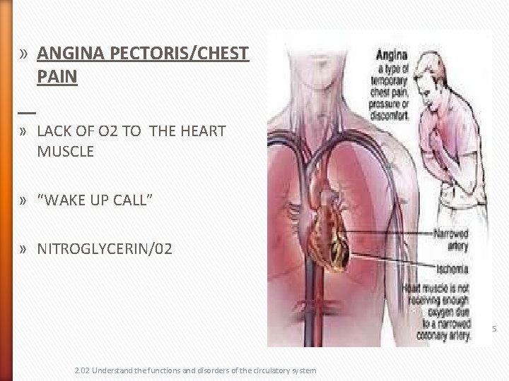 » ANGINA PECTORIS/CHEST PAIN » LACK OF O 2 TO THE HEART MUSCLE »