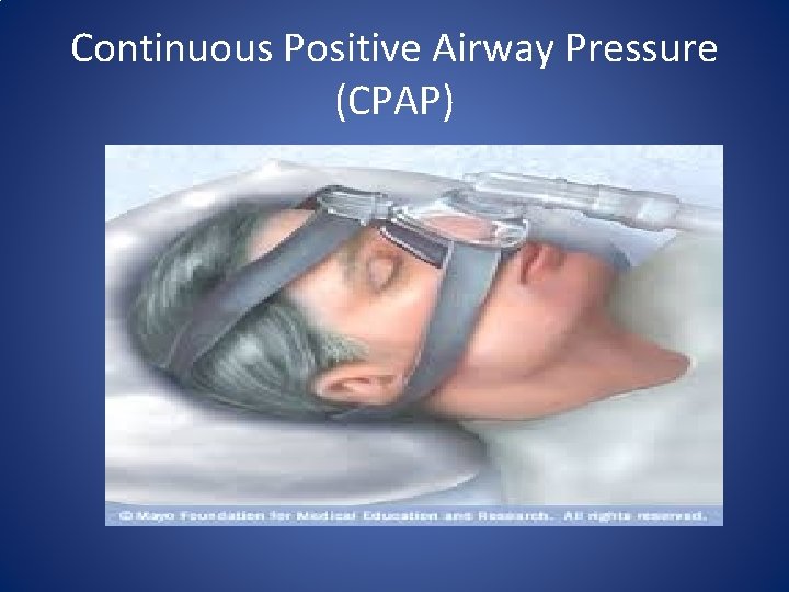 Continuous Positive Airway Pressure (CPAP) 