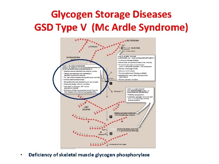 Glycogen Storage Diseases GSD Type V (Mc Ardle Syndrome) • Deficiency of skeletal muscle