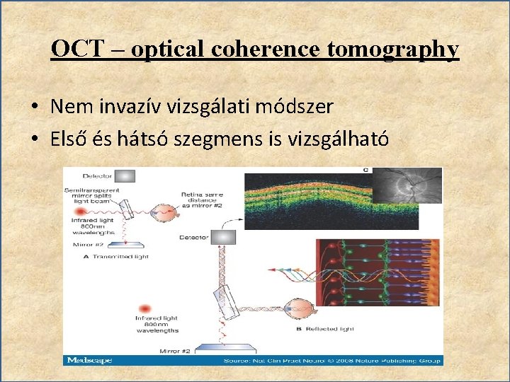 OCT – optical coherence tomography • Nem invazív vizsgálati módszer • Első és hátsó
