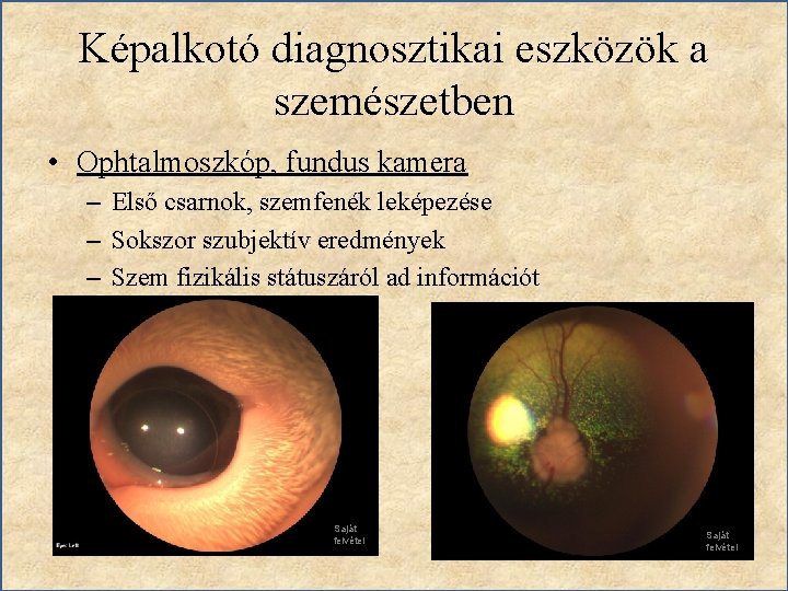 Képalkotó diagnosztikai eszközök a szemészetben • Ophtalmoszkóp, fundus kamera – Első csarnok, szemfenék leképezése