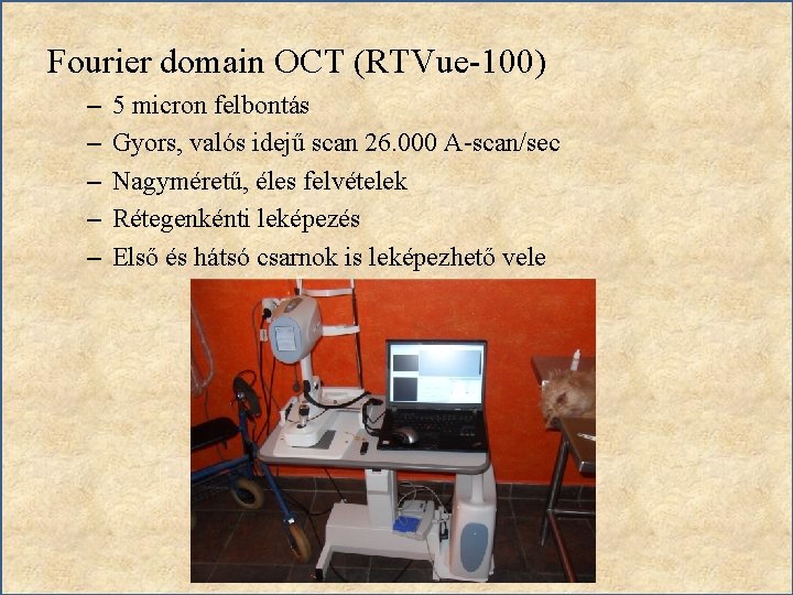 Fourier domain OCT (RTVue-100) – – – 5 micron felbontás Gyors, valós idejű scan