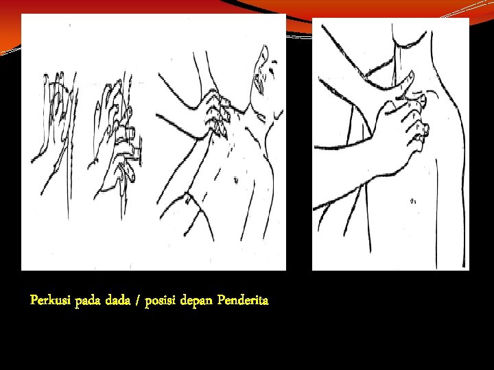 Perkusi pada dada / posisi depan Penderita 
