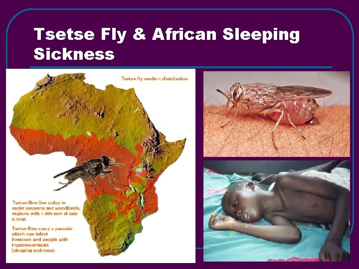 Tsetse Fly & African Sleeping Sickness 