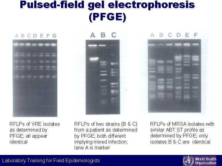 Pulsed-field gel electrophoresis (PFGE) RFLPs of VRE isolates as determined by PFGE; all appear