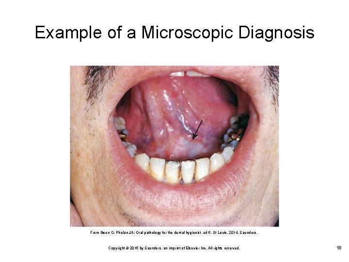 Example of a Microscopic Diagnosis From Ibsen O, Phelan JA: Oral pathology for the