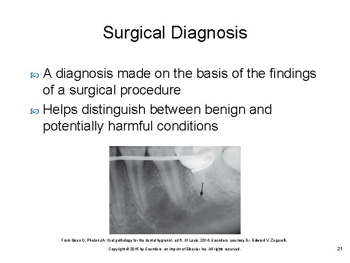Surgical Diagnosis A diagnosis made on the basis of the findings of a surgical