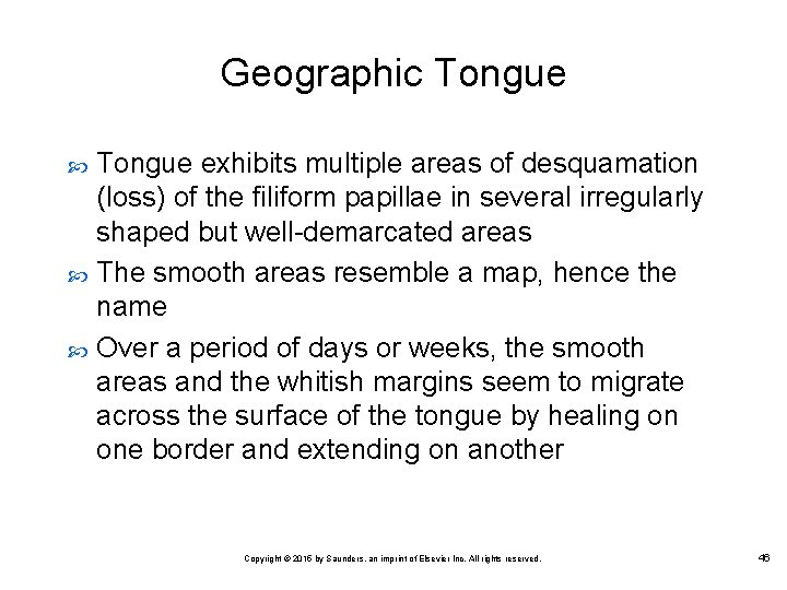 Geographic Tongue exhibits multiple areas of desquamation (loss) of the filiform papillae in several