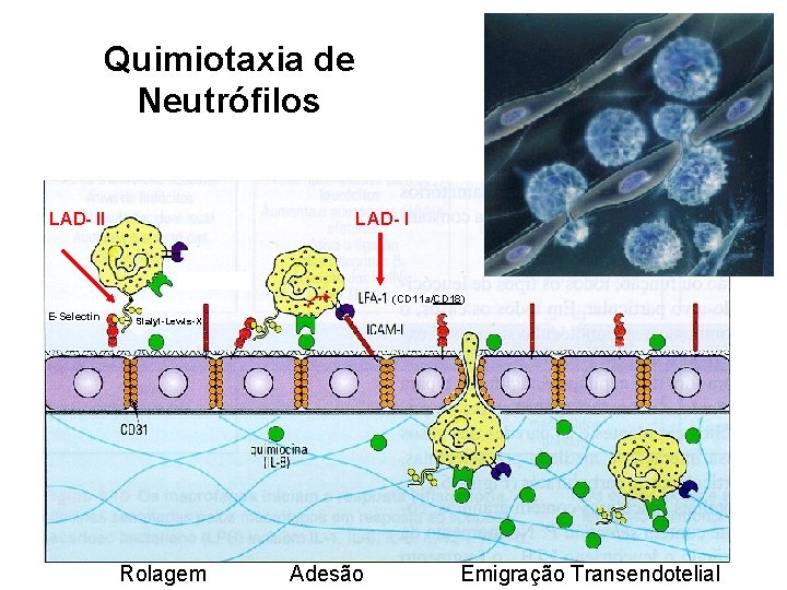Quimiotaxia de Neutrófilos LAD- II (CD 11 a/CD 18) E-Selectin Sialyl-Lewis-X Rolagem Adesão Emigração
