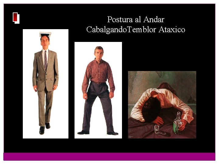 Postura al Andar Cabalgando. Temblor Ataxico 