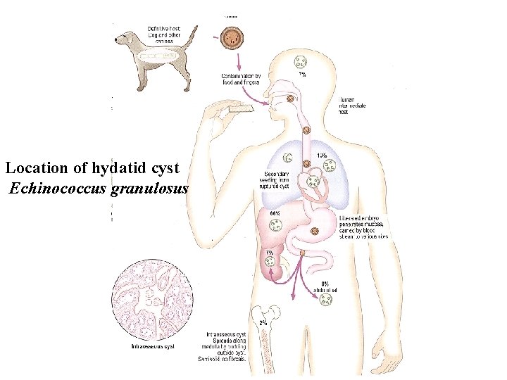 Location of hydatid cyst Echinococcus granulosus 