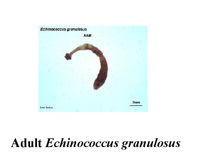 Adult Echinococcus granulosus 