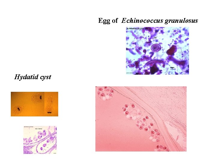 Egg of Echinococcus granulosus Hydatid cyst 