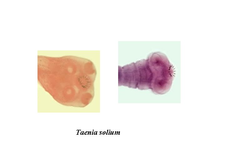 Taenia solium 