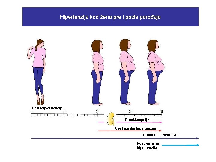Hipertenzija kod žena pre i posle porođaja Gestacijska nedelja Preeklampsija Gestacijska hipertenzija Hronična hipertenzija