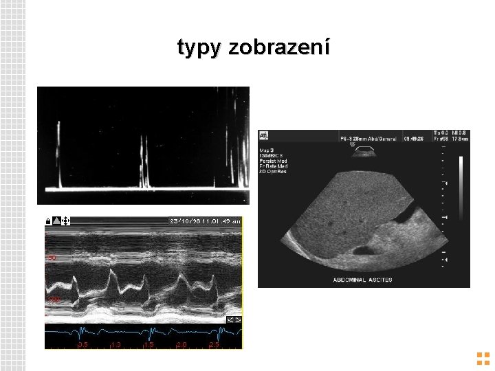 typy zobrazení 