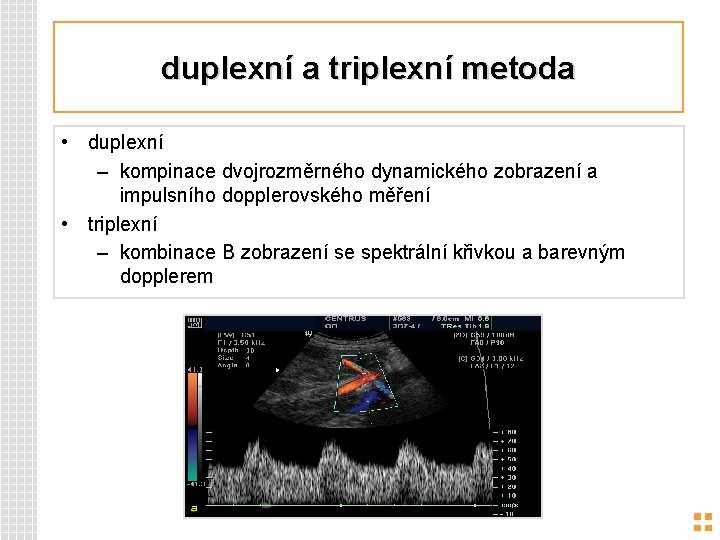 duplexní a triplexní metoda • duplexní – kompinace dvojrozměrného dynamického zobrazení a impulsního dopplerovského