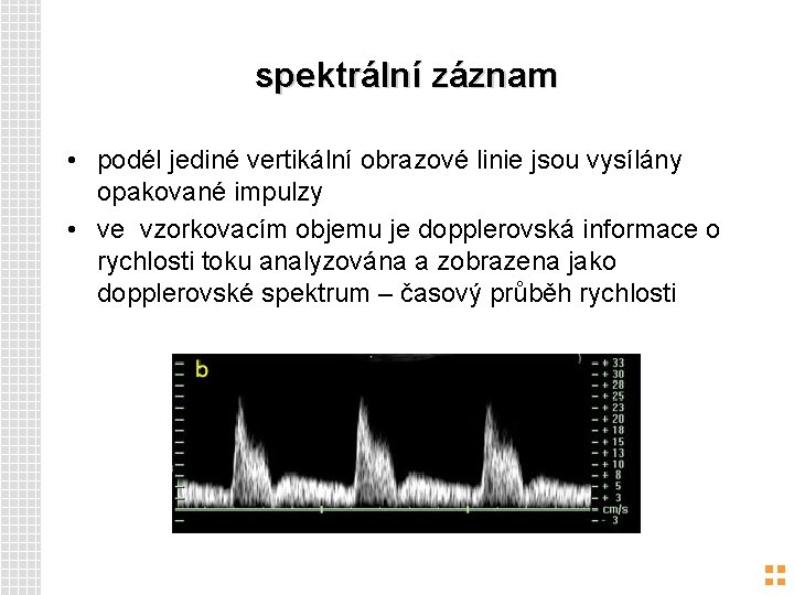 spektrální záznam • podél jediné vertikální obrazové linie jsou vysílány opakované impulzy • ve