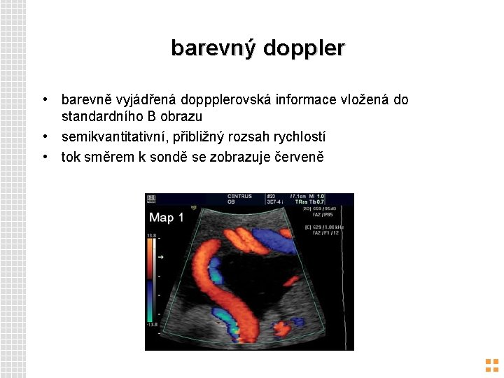 barevný doppler • barevně vyjádřená doppplerovská informace vložená do standardního B obrazu • semikvantitativní,