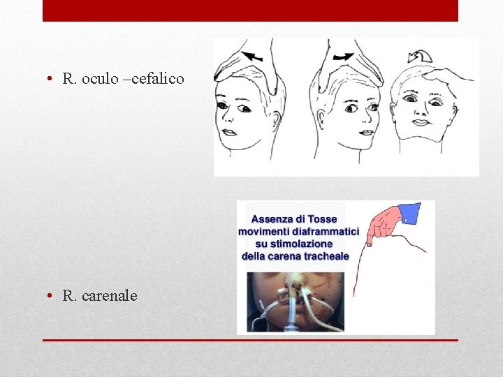  • R. oculo –cefalico • R. carenale 