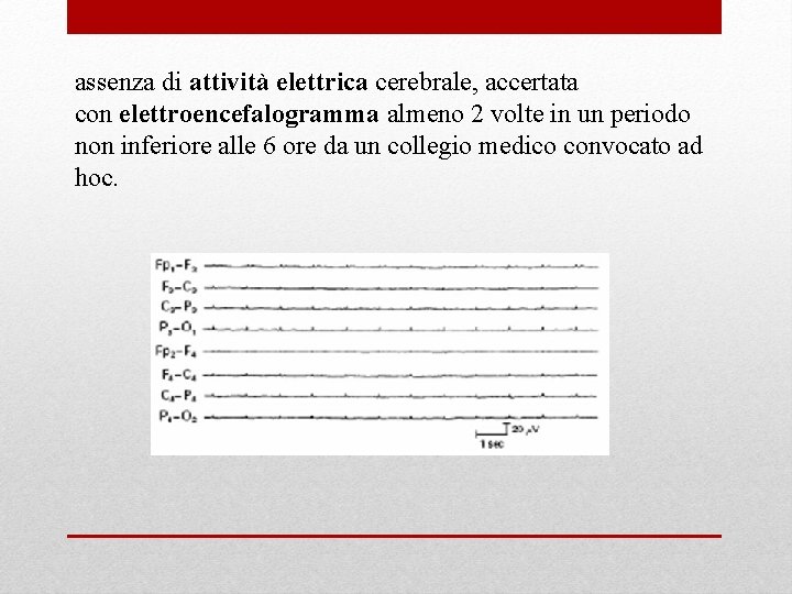 assenza di attività elettrica cerebrale, accertata con elettroencefalogramma almeno 2 volte in un periodo