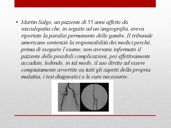  • Martin Salgo, un paziente di 55 anni affetto da vasculopatia che, in