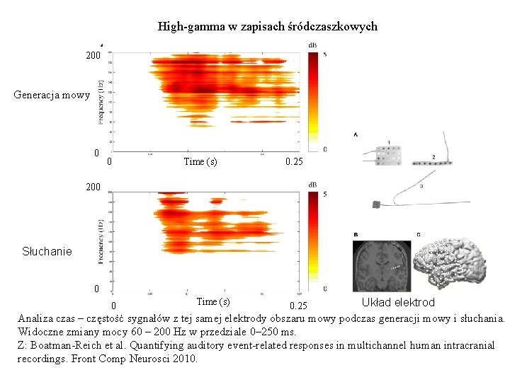 High-gamma w zapisach śródczaszkowych 200 Generacja mowy 0 0 Time (s) 0. 25 200