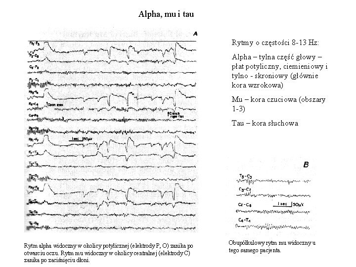 Alpha, mu i tau Rytmy o częstości 8 -13 Hz: Alpha – tylna część