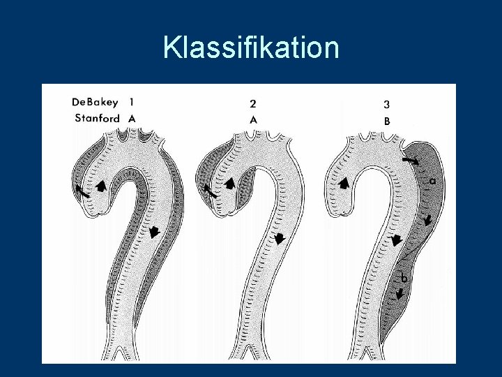 Klassifikation 