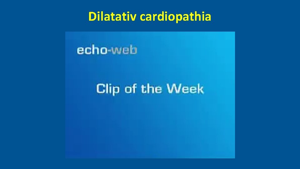 Dilatativ cardiopathia 