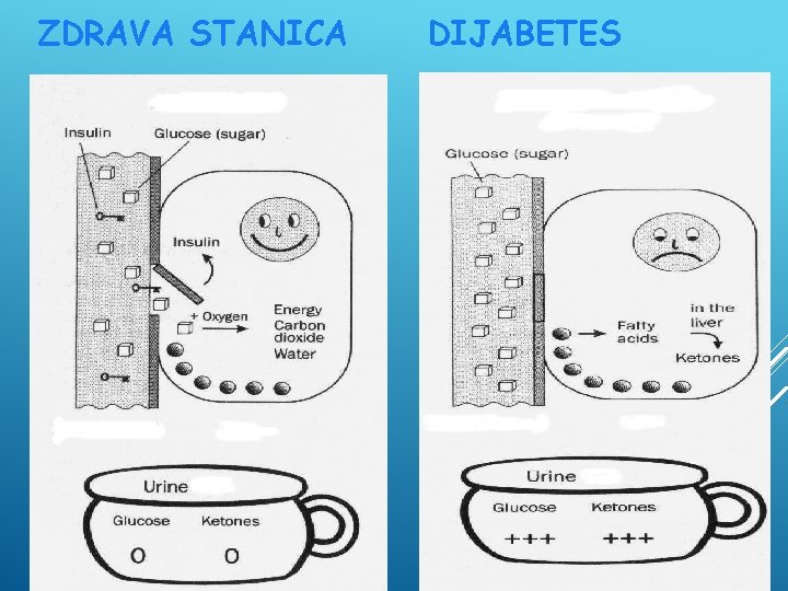 ZDRAVA STANICA DIJABETES 