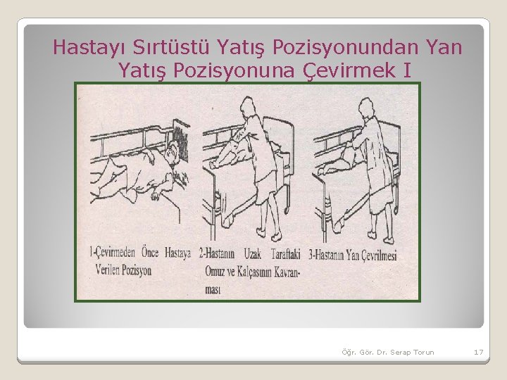 Hastayı Sırtüstü Yatış Pozisyonundan Yatış Pozisyonuna Çevirmek I Öğr. Gör. Dr. Serap Torun 17